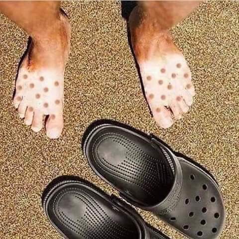 Bronzage des pieds cet été avec des crocs.